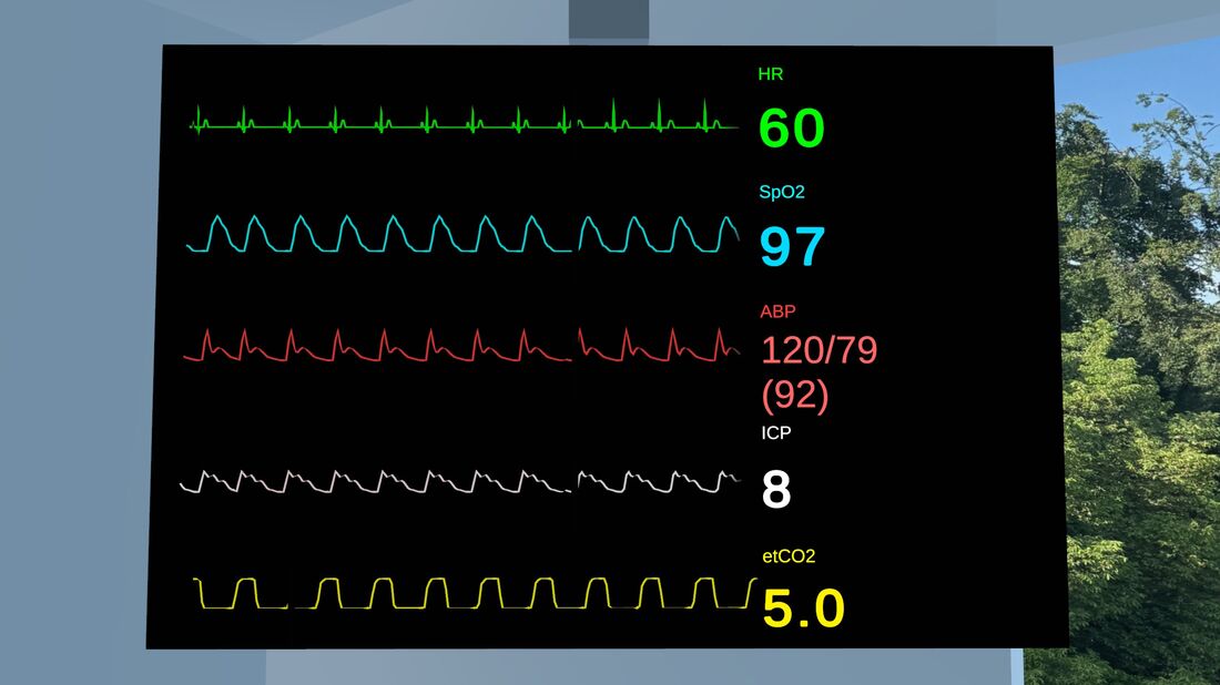 Den virtuelle patientmonitor med EKG, SpO2, blodtryk, ICP og etCO2